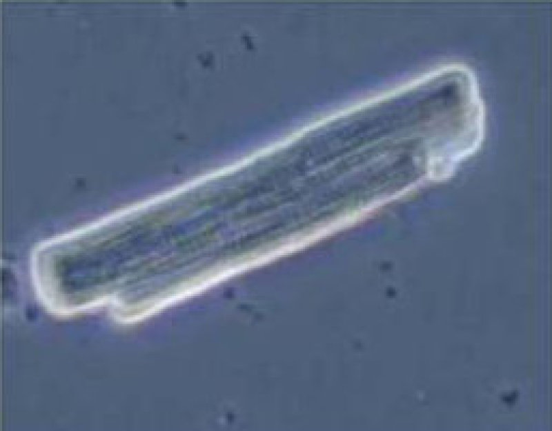 Ventricular Myocytes